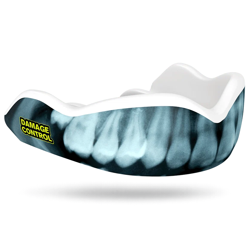 Protector bucal damage X Ray