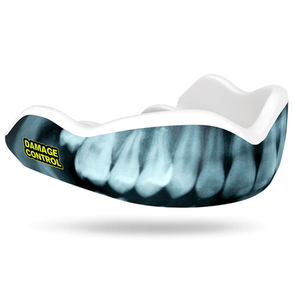Protector bucal damage X Ray