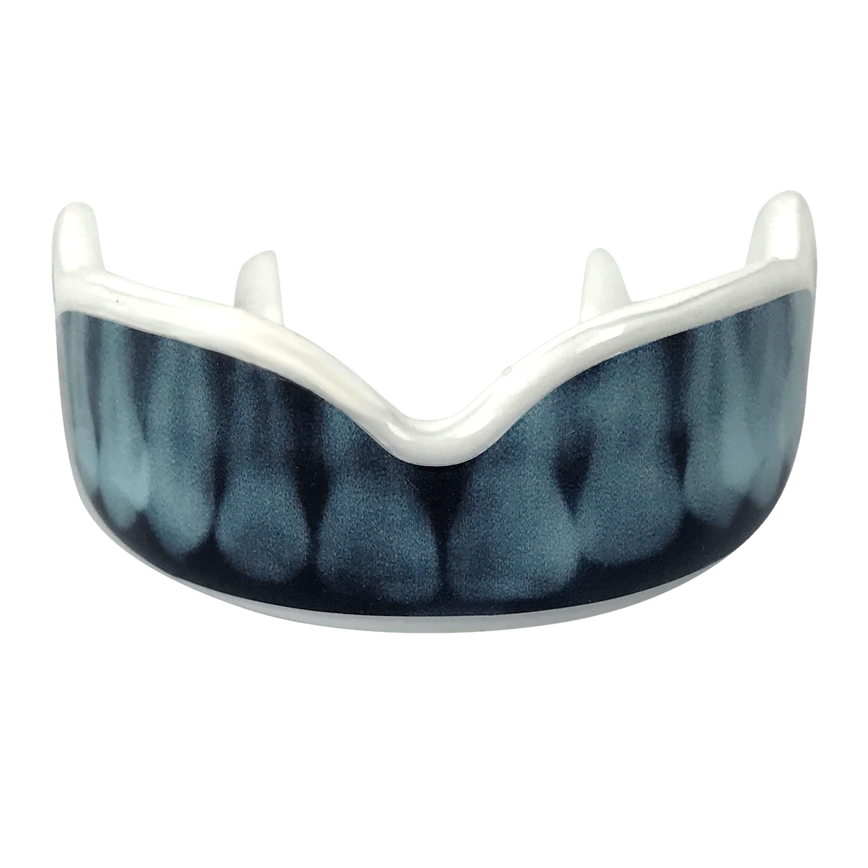 Protector bucal damage X Ray